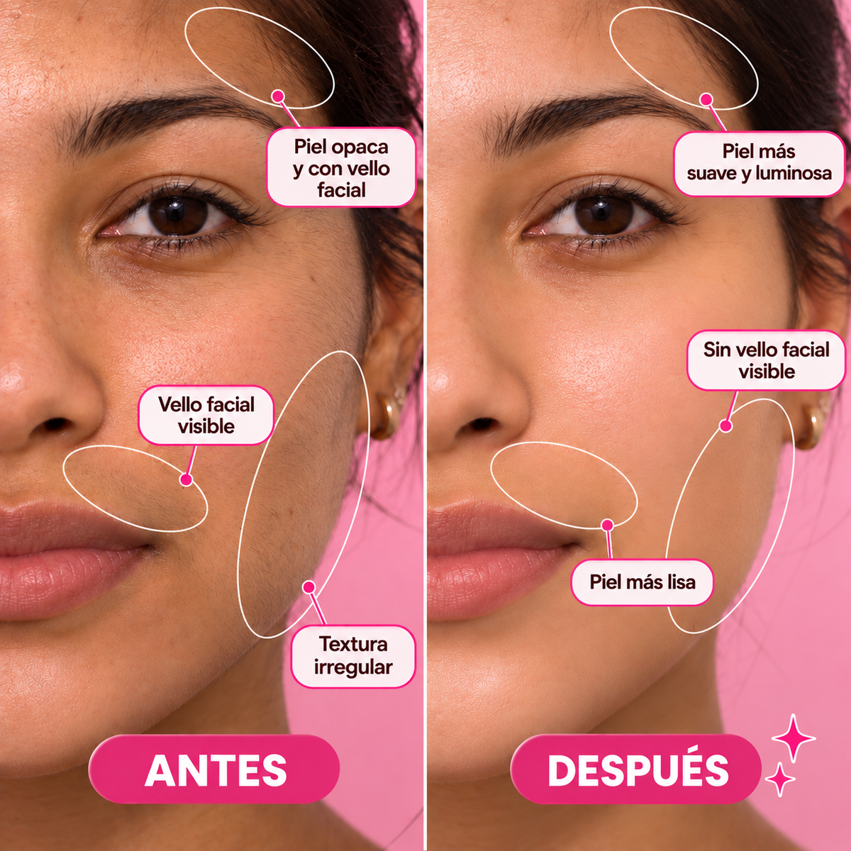Depiladora SkiNova™/ SEGURO + SUAVE Descubre una piel suave y libre de vello