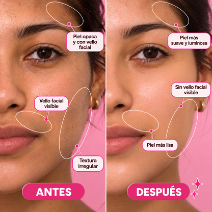 Depiladora SkiNova™/ SEGURO + SUAVE Descubre una piel suave y libre de vello